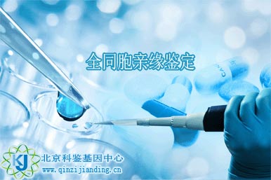 同父同母親緣關(guān)系鑒定