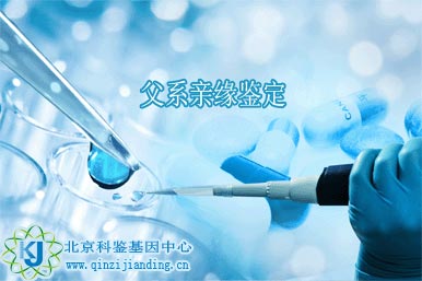 同一父系親緣關(guān)系鑒定