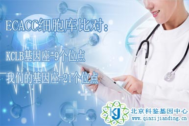 細(xì)胞鑒定-KCLB細(xì)胞庫(kù)比對(duì)