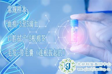 常規(guī)親子鑒定樣本