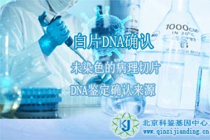 特殊樣本DNA鑒定